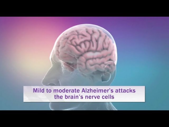 Alzheimer's Disease Explained in 6 minutes with Animation